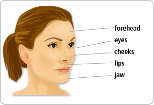 restylane facial areas